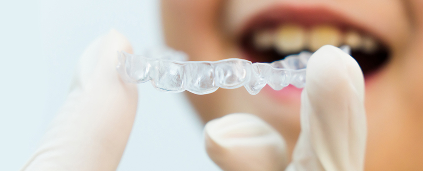 invisalig first ortodoncia invisible para niños